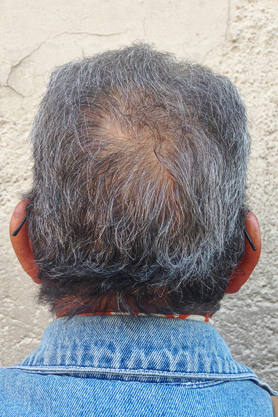 Anoukkruithof final ahead 0477