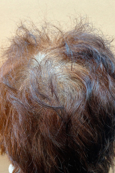 Anoukkruithof final ahead 0175