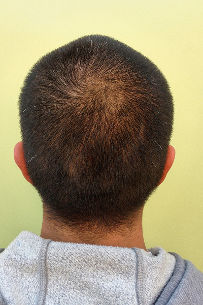 Anoukkruithof final ahead 0182