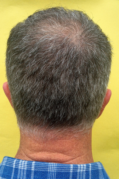 Anoukkruithof final ahead 0189