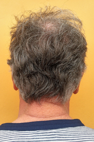 Anoukkruithof final ahead 0251