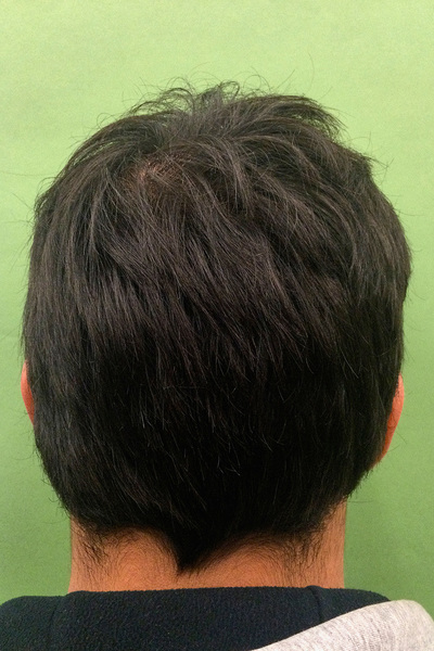 Anoukkruithof final ahead 0318