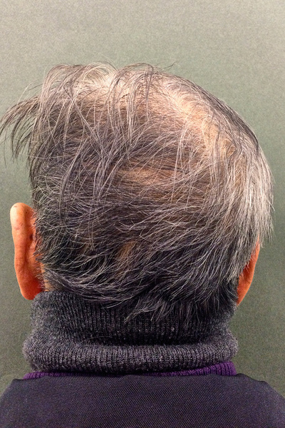 Anoukkruithof final ahead 0352