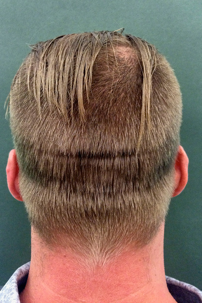 Anoukkruithof final ahead 0354