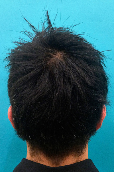 Anoukkruithof final ahead 0390