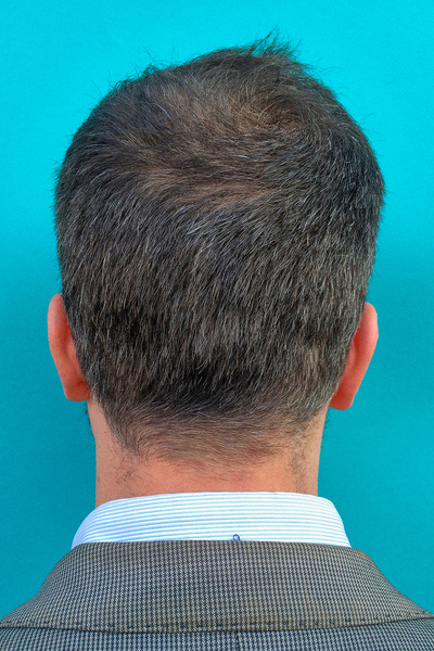 Anoukkruithof final ahead 0411