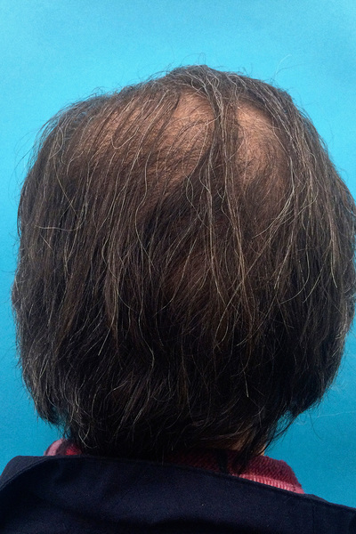 Anoukkruithof final ahead 0414