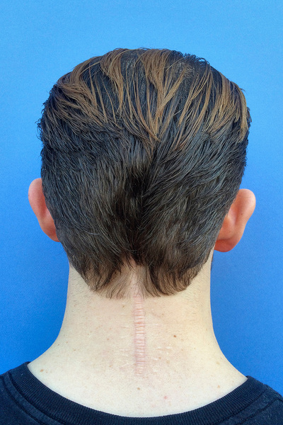 Anoukkruithof final ahead 0415