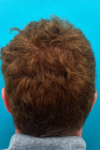 Anoukkruithof final ahead 0417