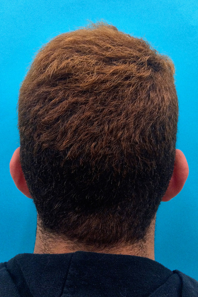 Anoukkruithof final ahead 0423