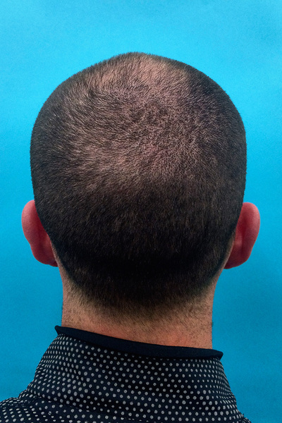 Anoukkruithof final ahead 0421