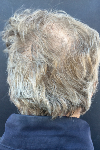 Anoukkruithof final ahead 0495