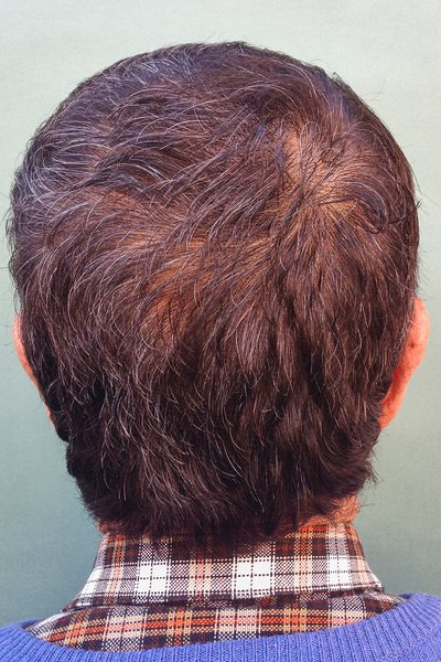 Anoukkruithof final ahead 0513