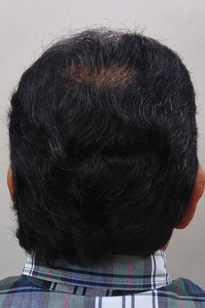 Anoukkruithof final ahead 0552