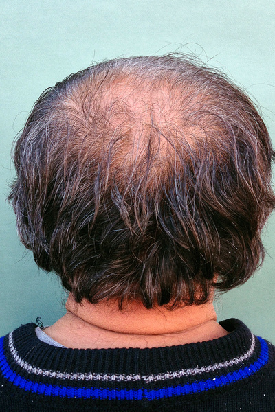 Anoukkruithof final ahead 0859