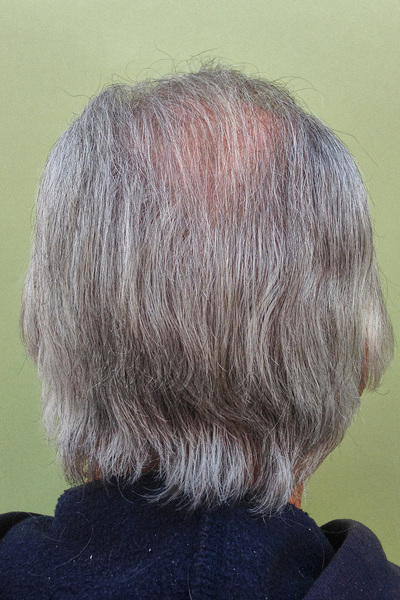 Anoukkruithof final ahead 0893