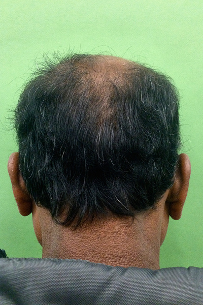 Anoukkruithof final ahead 0904