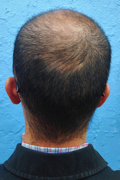 Anoukkruithof final ahead 0933