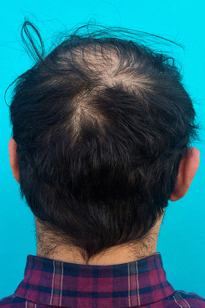 Anoukkruithof final ahead 0950