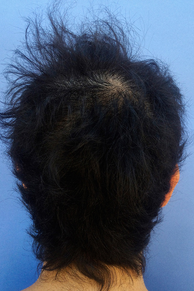 Anoukkruithof final ahead 0995