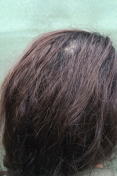 Anoukkruithof final ahead 1029