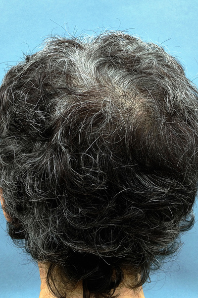 Anoukkruithof final ahead 1034