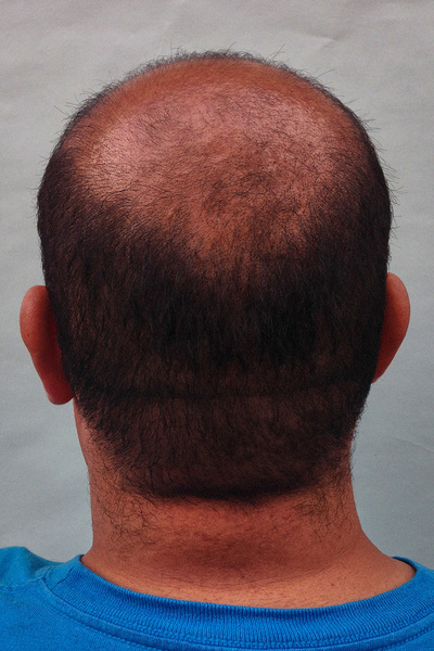 Anoukkruithof final ahead 1047